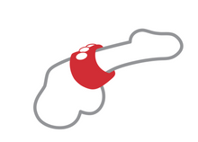 Load image into Gallery viewer, Metro RingMaster Silicone Snap Support Ring
